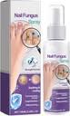 Nail Fungus Spray|Specially For UAE|