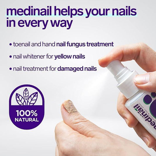 Hand spraying Medinail nail fungus treatment on toenail, highlights natural antifungal, whitening, and repair benefits.